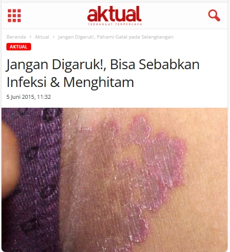 AKTUAL-BERITA-SLENGKY-1.webp